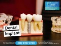 Dental Implants Armadale WA 6112 - All on 4 Dental Implants - Armadale Dental Centre