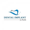 Dental Implant in Balcatta Perth - Dentist in Perth - All on 4 Dental Implant